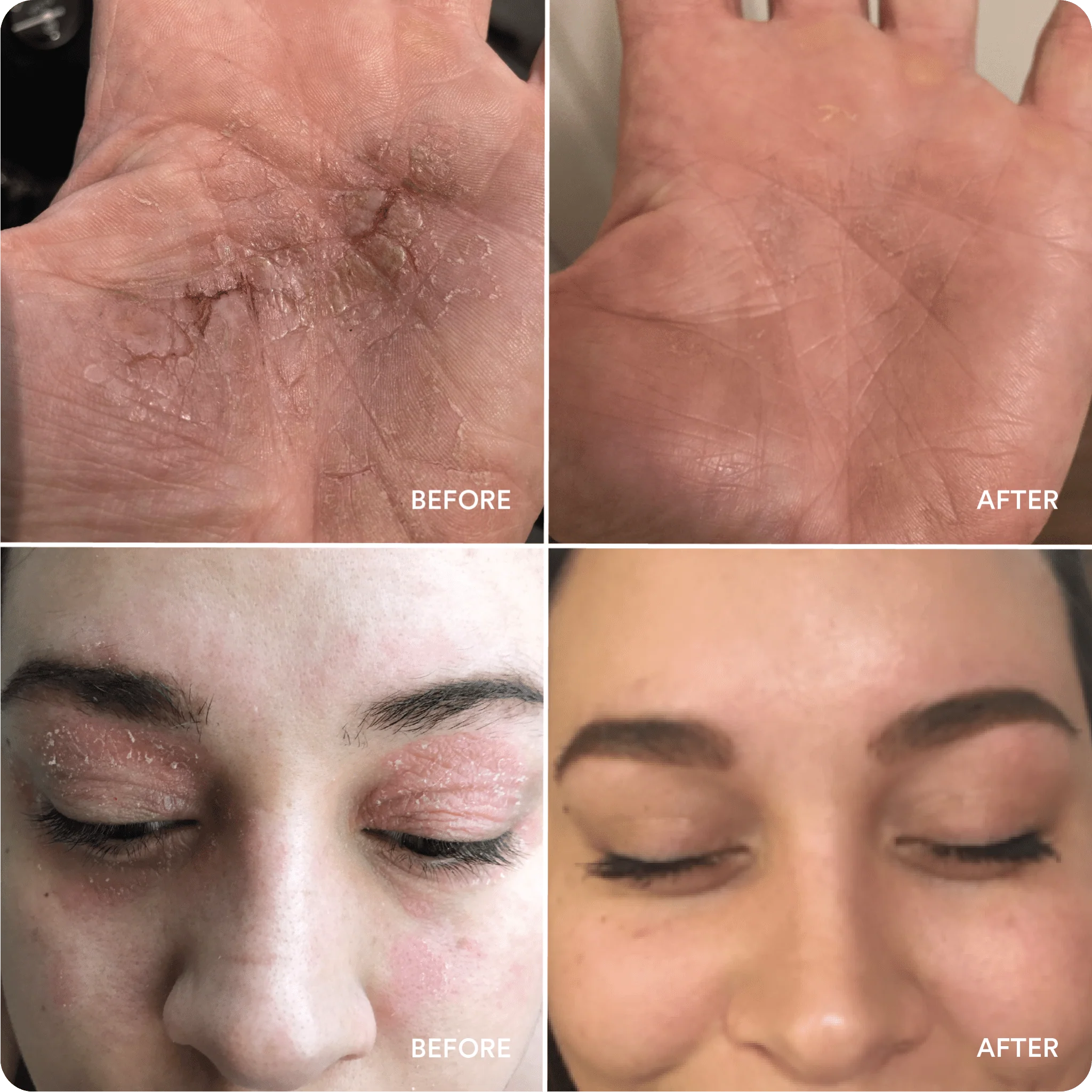 Soothing Hydration Cream - Image 4